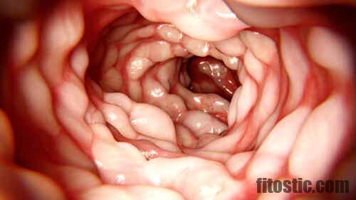 Est-ce que l'on meurt de la maladie de Crohn ?