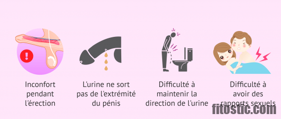 Est-ce que l'urine sort du clitoris ?