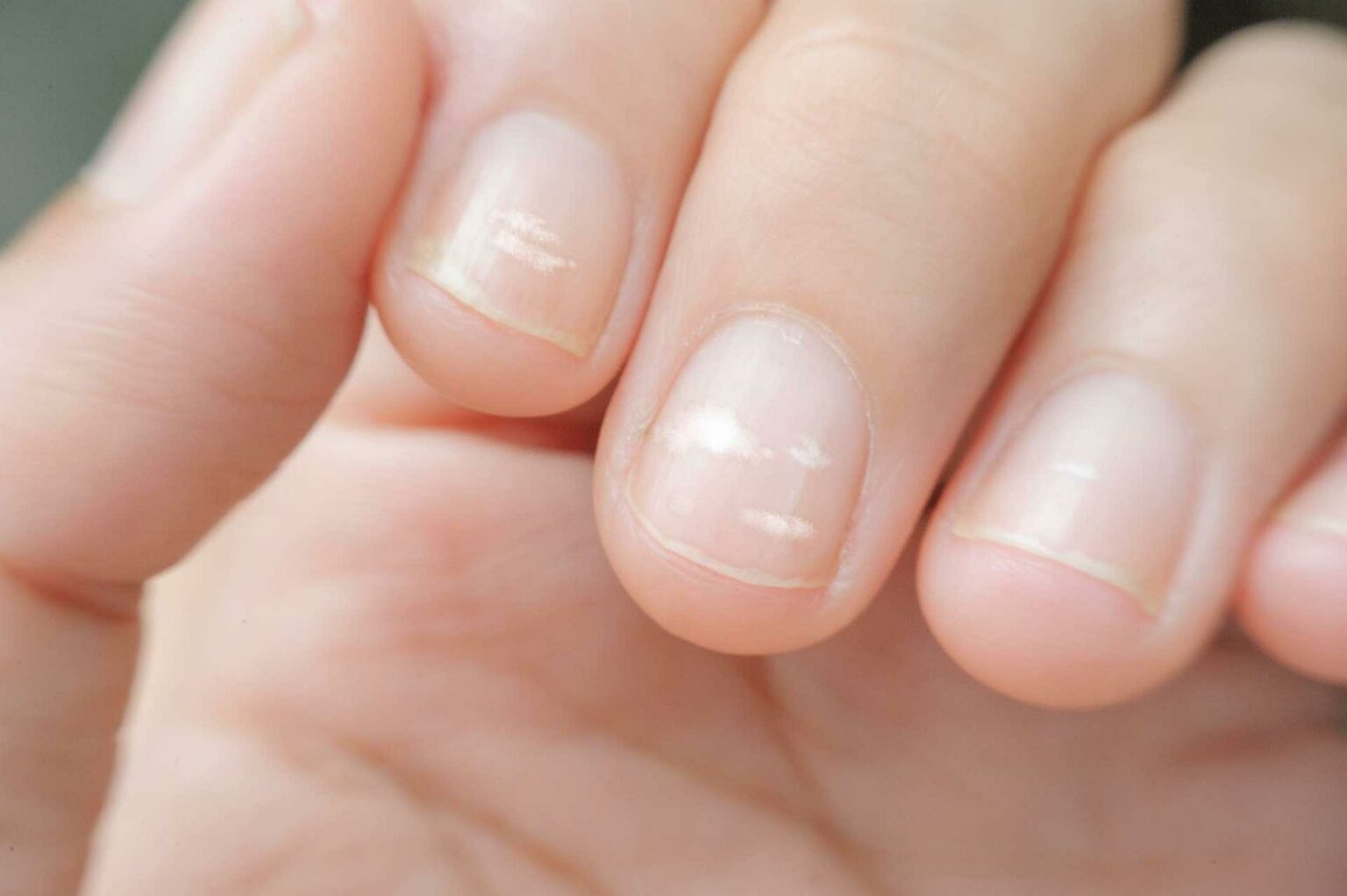 Pourquoi j'ai des taches oranges sur les mains ? - Fitostic.com - Sport