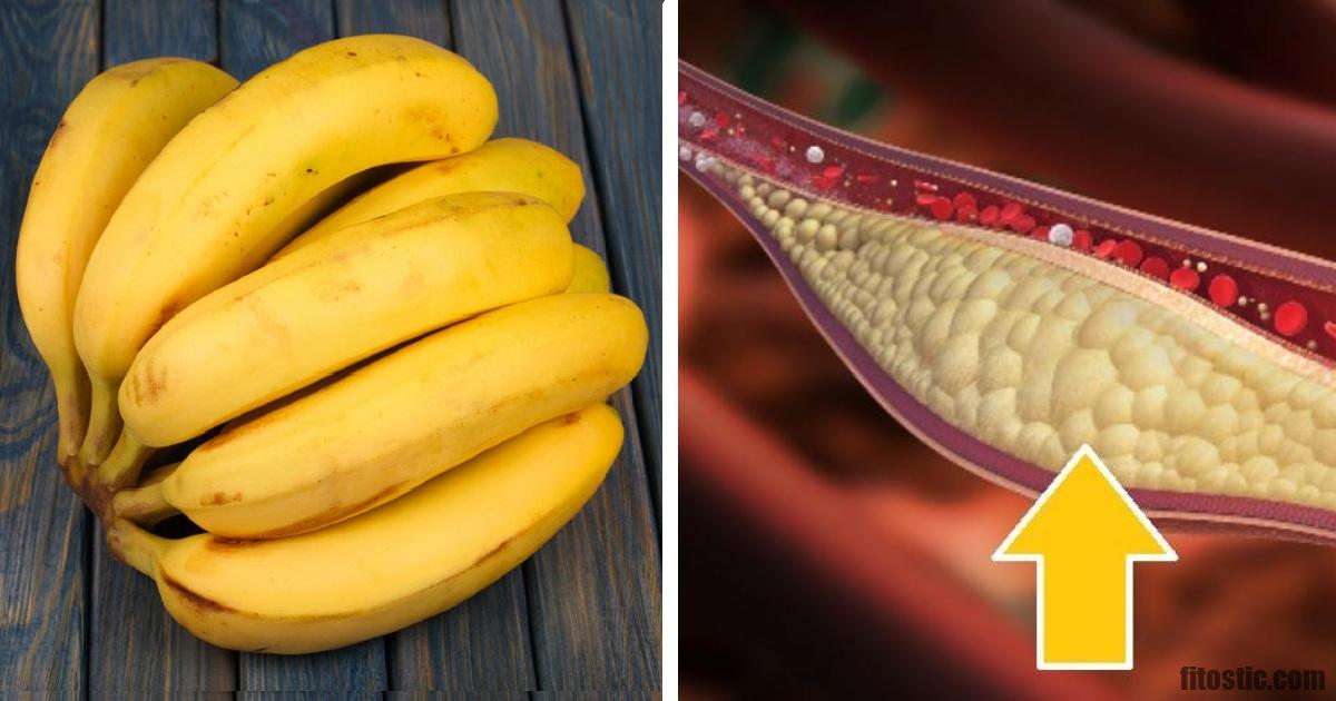 Pourquoi la banane est mauvaise pour la santé ?