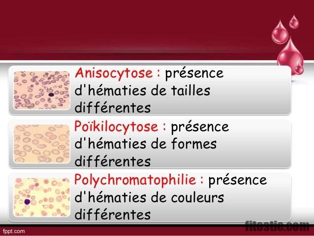 Quand Parle-t-on d'anémie macrocytaire ?