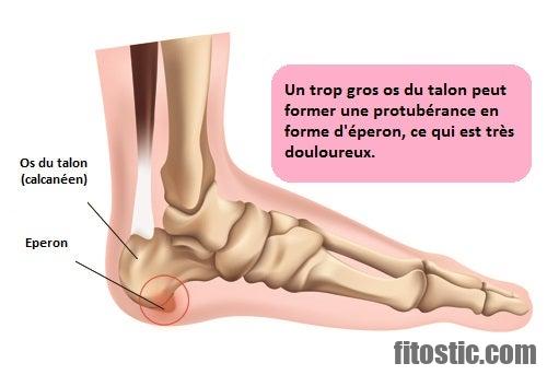 Quand apparaissent les douleurs ligamentaires ?