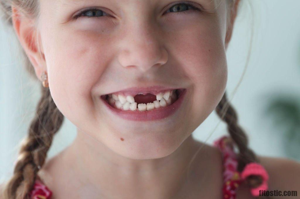 Quand on rêve de dents qui tombent ?