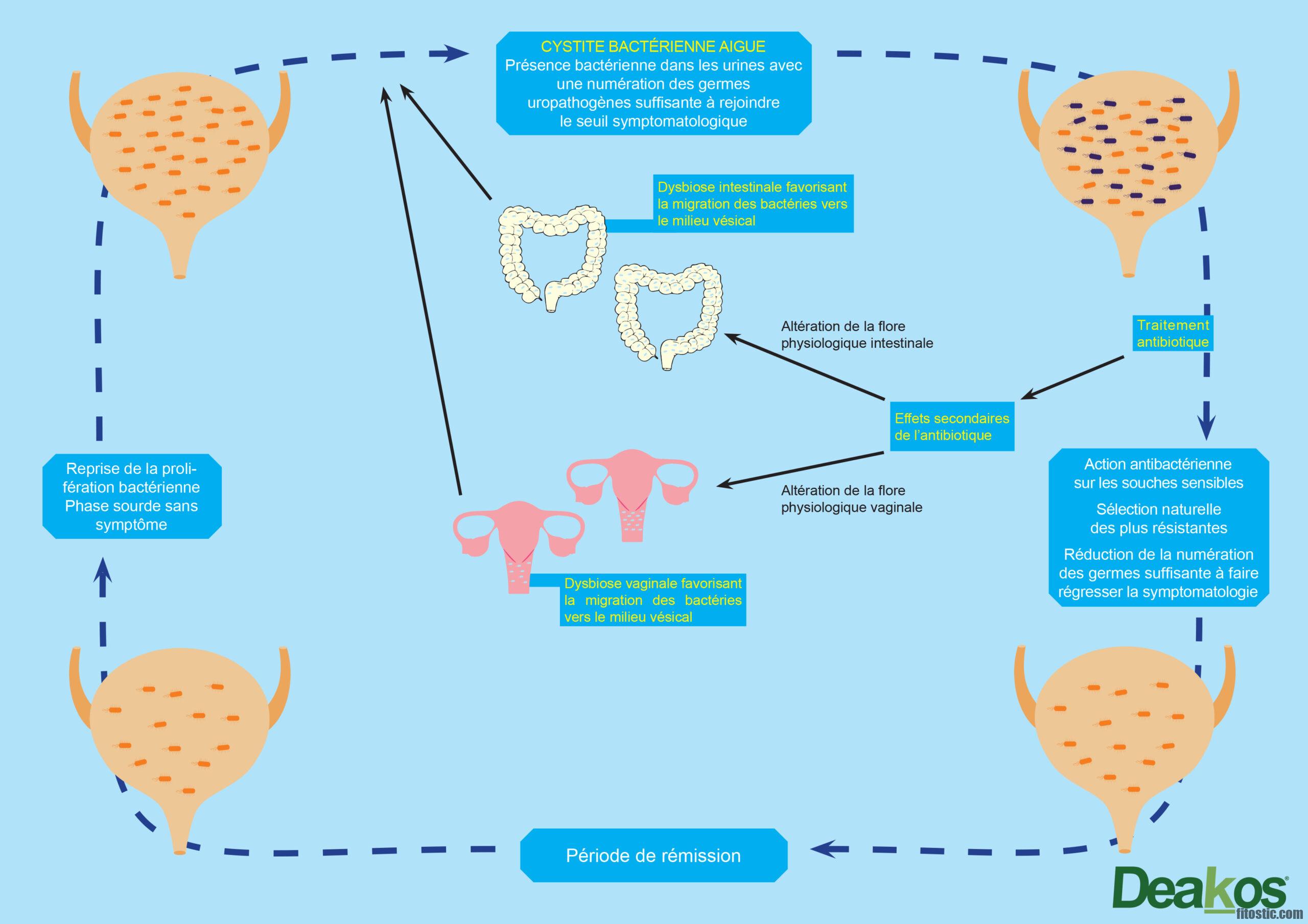 Quand s'arrête une infection urinaire ?