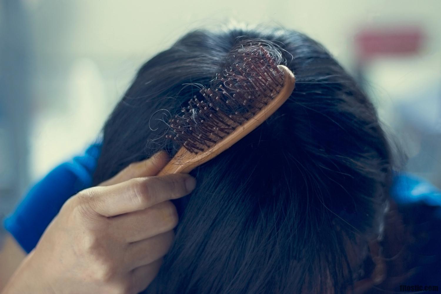 Quand s'inquiéter de la perte de cheveux ?