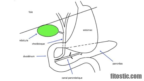 Quel aliment à eviter pour la vésicule biliaire ?