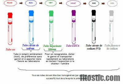 Quel bilan sanguin pour rhumatisme ?