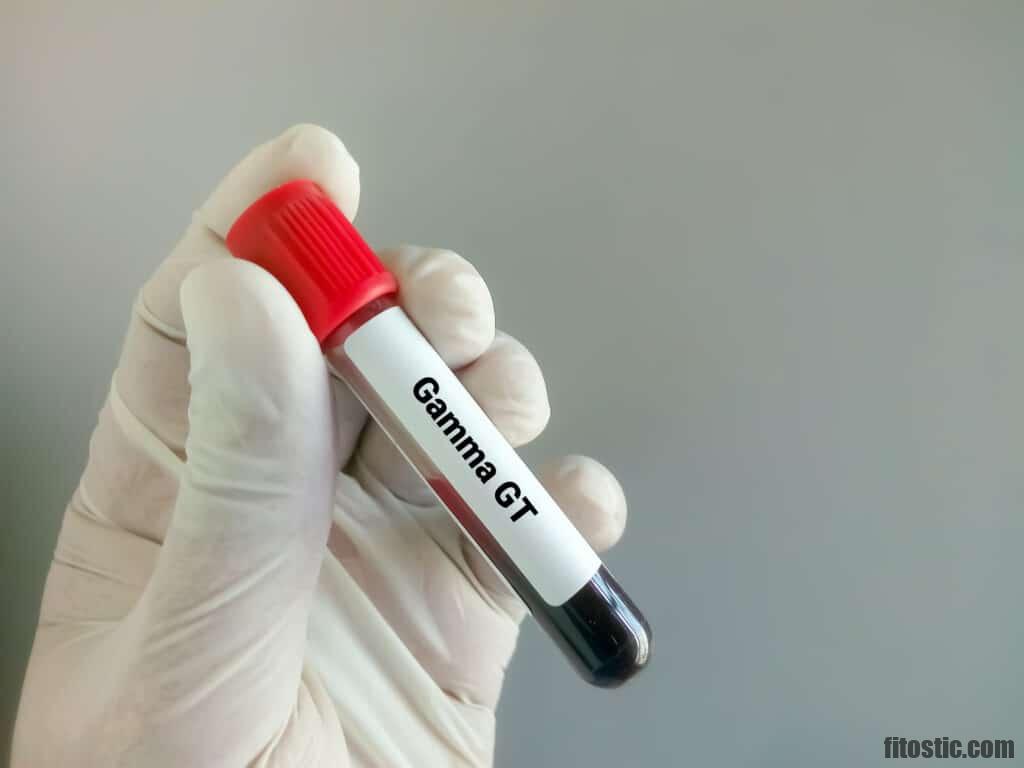 Quel délai pour faire baisser les gamma GT ? Sport, Mode, Beauté & lifestyle Quel délai pour faire baisser les gamma GT ? Sport, Mode, Beauté & lifestyle
