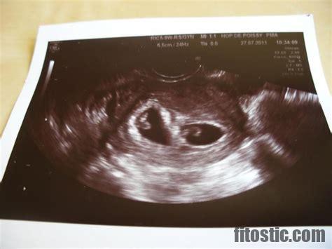 Quel est le poid d'un fœtus de 6 mois ?
