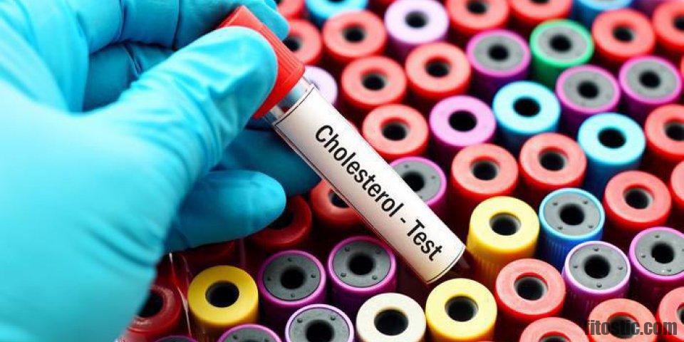 Quel est le taux de cholestérol total à ne pas dépasser ?