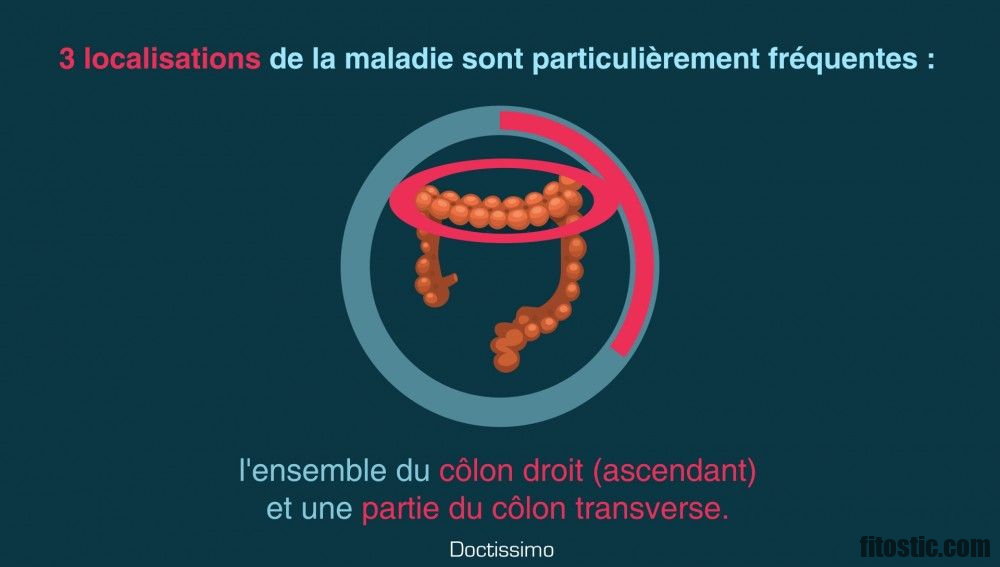 Quel maladie Peut-on voir dans les yeux ?