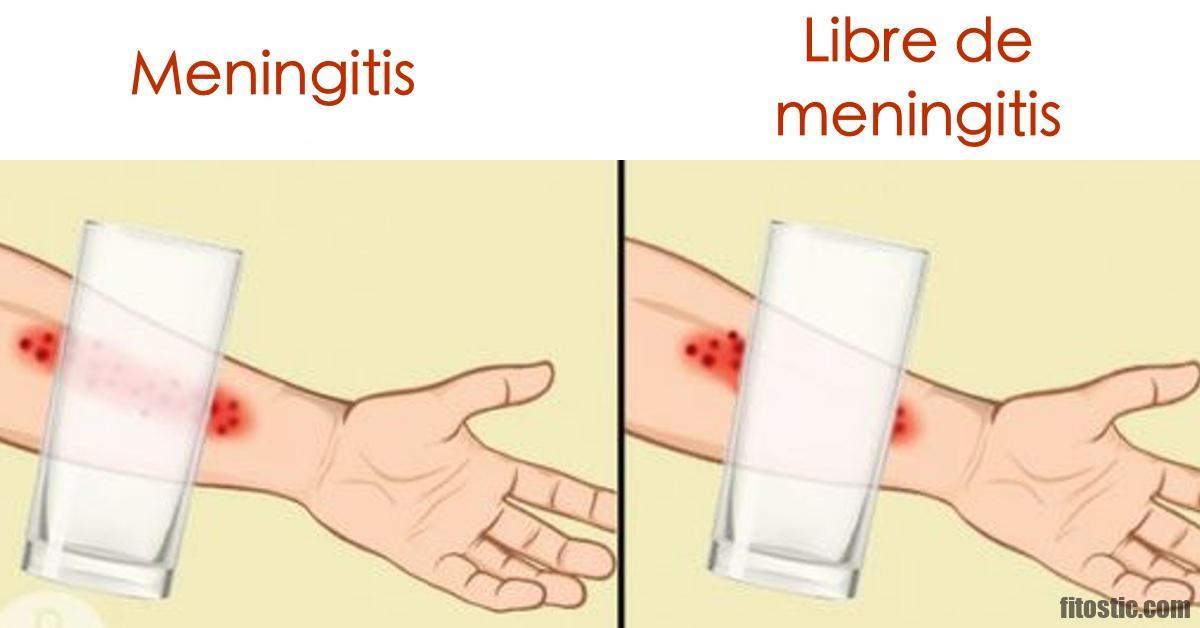 Quel sont les symptôme d'une meningite ?