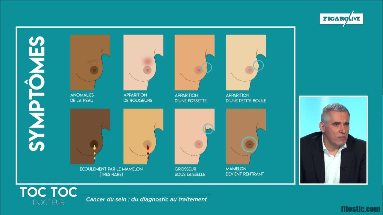 Quel symptôme pour un fibrome ?