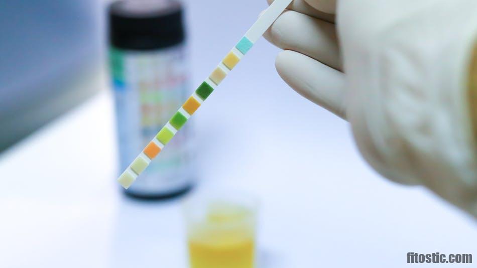 Quelle Est La Couleur De L Urine D Une Femme Enceinte Fitostic Com Sport Mode Beaute Lifestyle Magazine Quelle Est La Couleur De L Urine D Une Femme Enceinte Fitostic Com Sport Mode Beaute Lifestyle Magazine