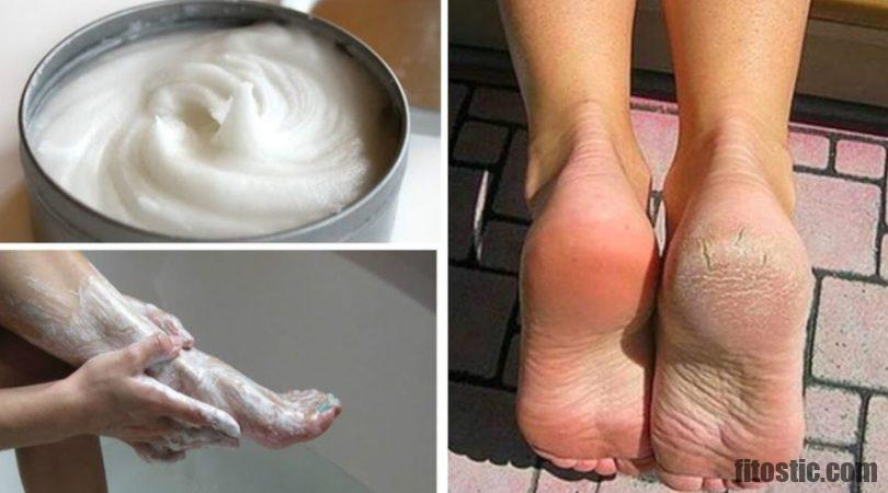 Quelles sont les conséquences des pieds plats ?