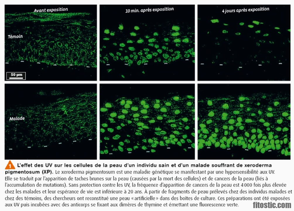 Quelles sont les conséquences d'une hémolyse ?