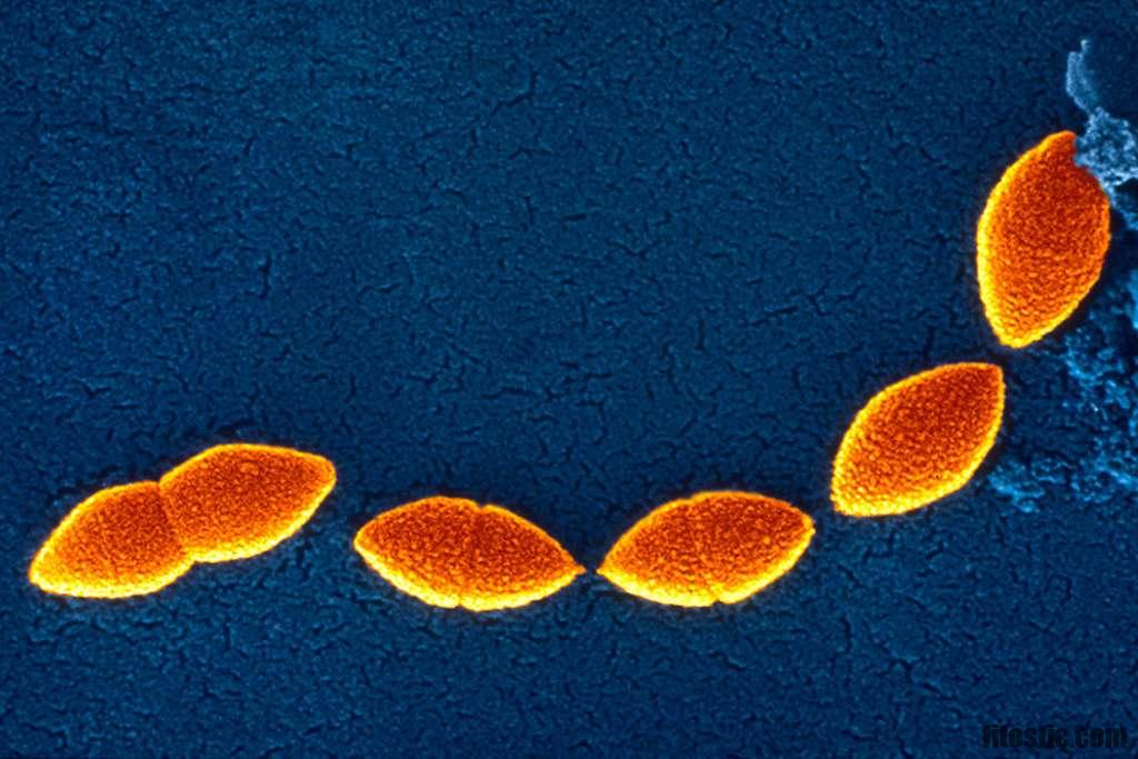 Quelles sont les séquelles d'une pneumonie ?