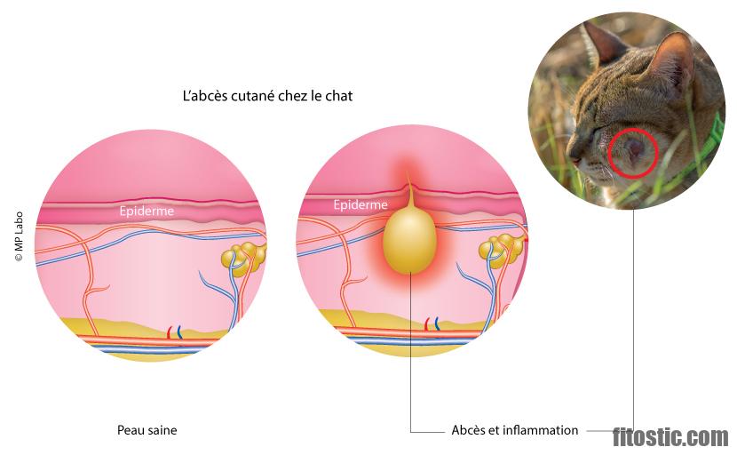 Quels sont les 2 types de plaies ?