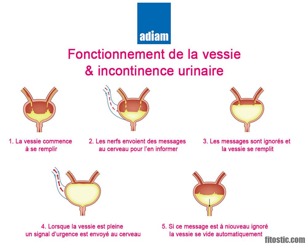 Quels sont les signes cliniques de l'incontinence urinaire ?