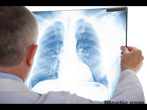 Quels sont les signes d'embolie pulmonaire ?