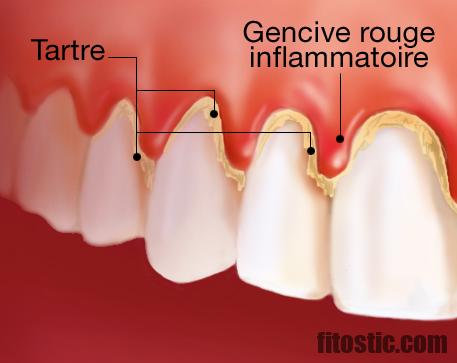 Quels sont les symptômes d'une mauvaise digestion ?