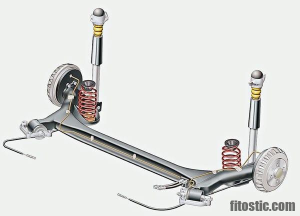 Qu'est-ce qu'une torsion de l'intestin ?