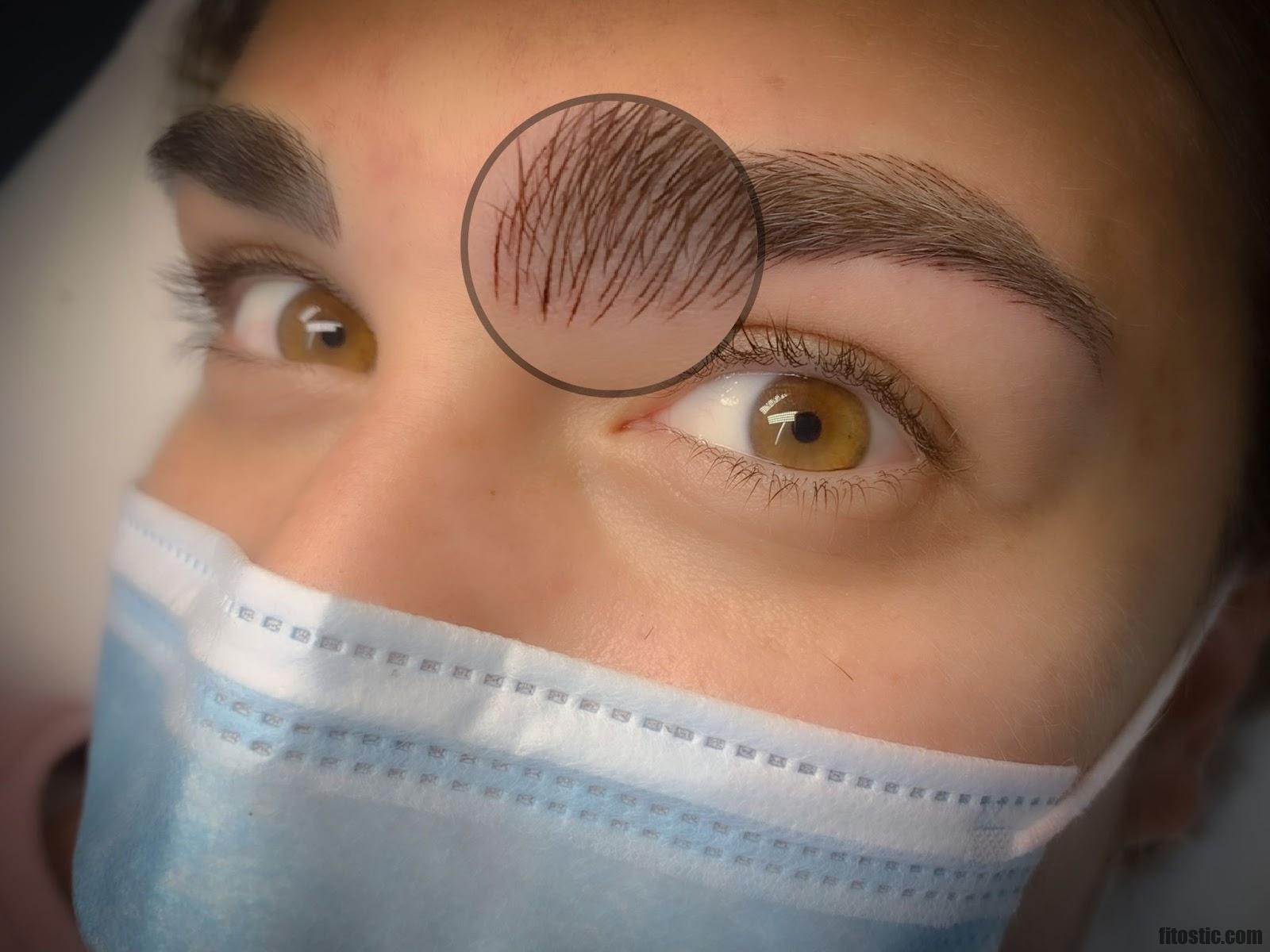 Comment accelerer cicatrisation microblading ?