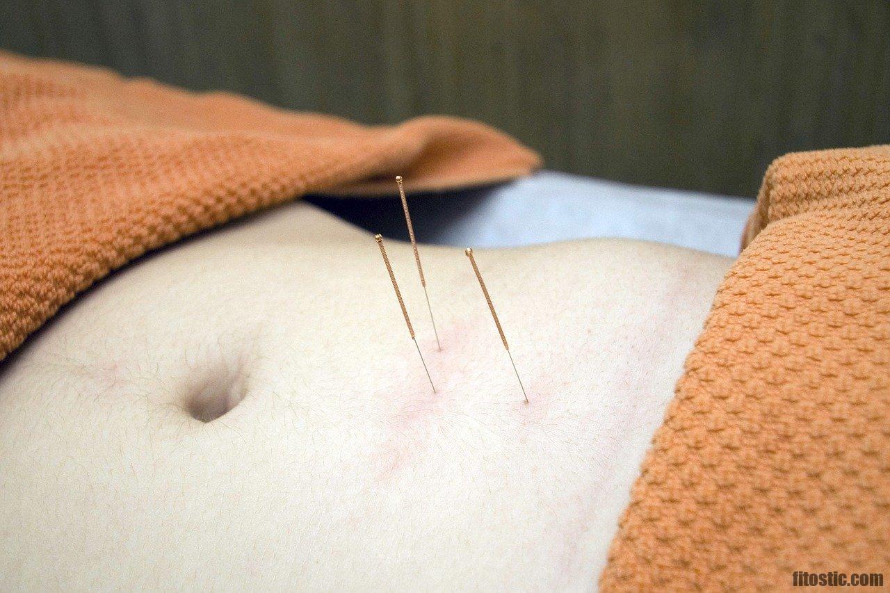 Comment savoir si c'est un bon acupuncteur ?