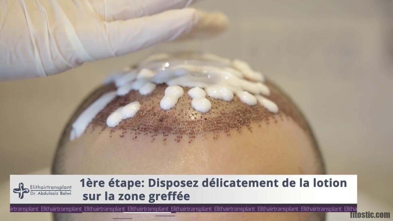 Comment se laver les cheveux après une opération des yeux ?