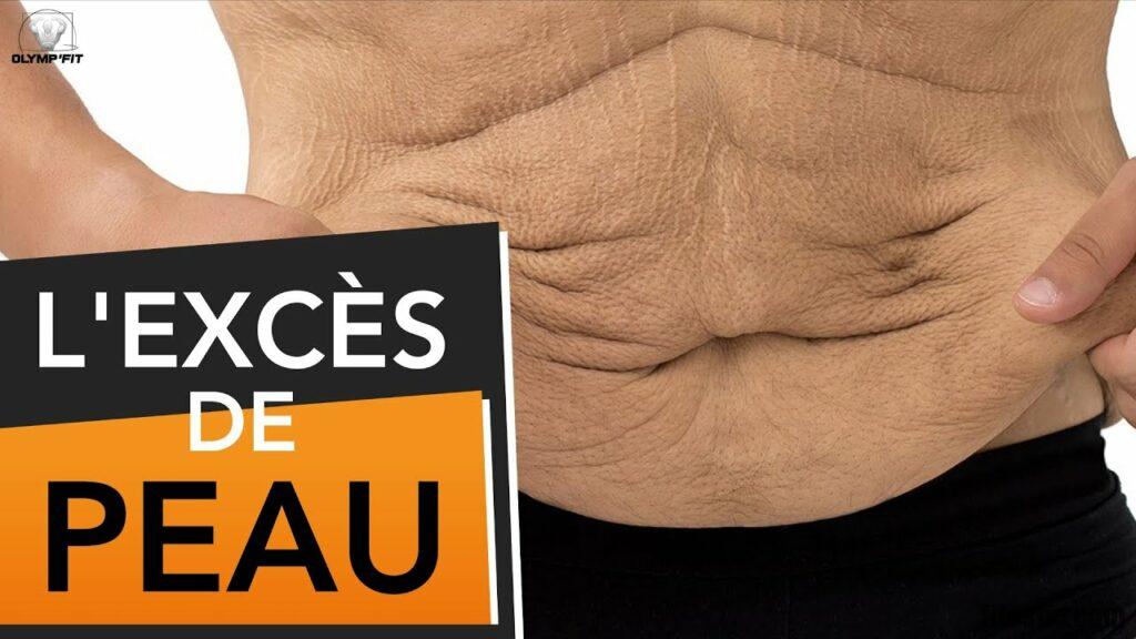 Comment éviter la peau qui pend après une sleeve