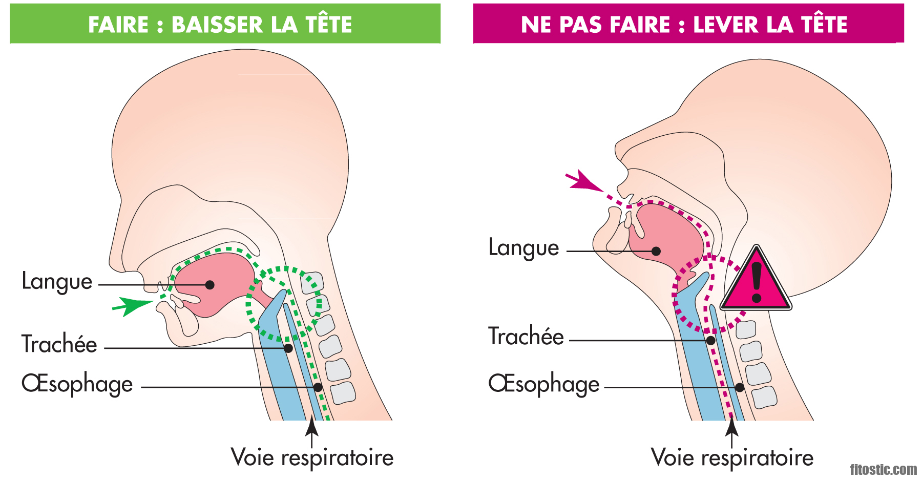 Comment faire quand on arrive pas à avaler ?