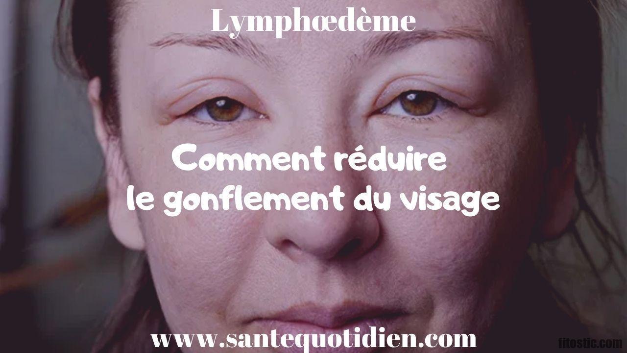 Comment réduire le gonflement ?