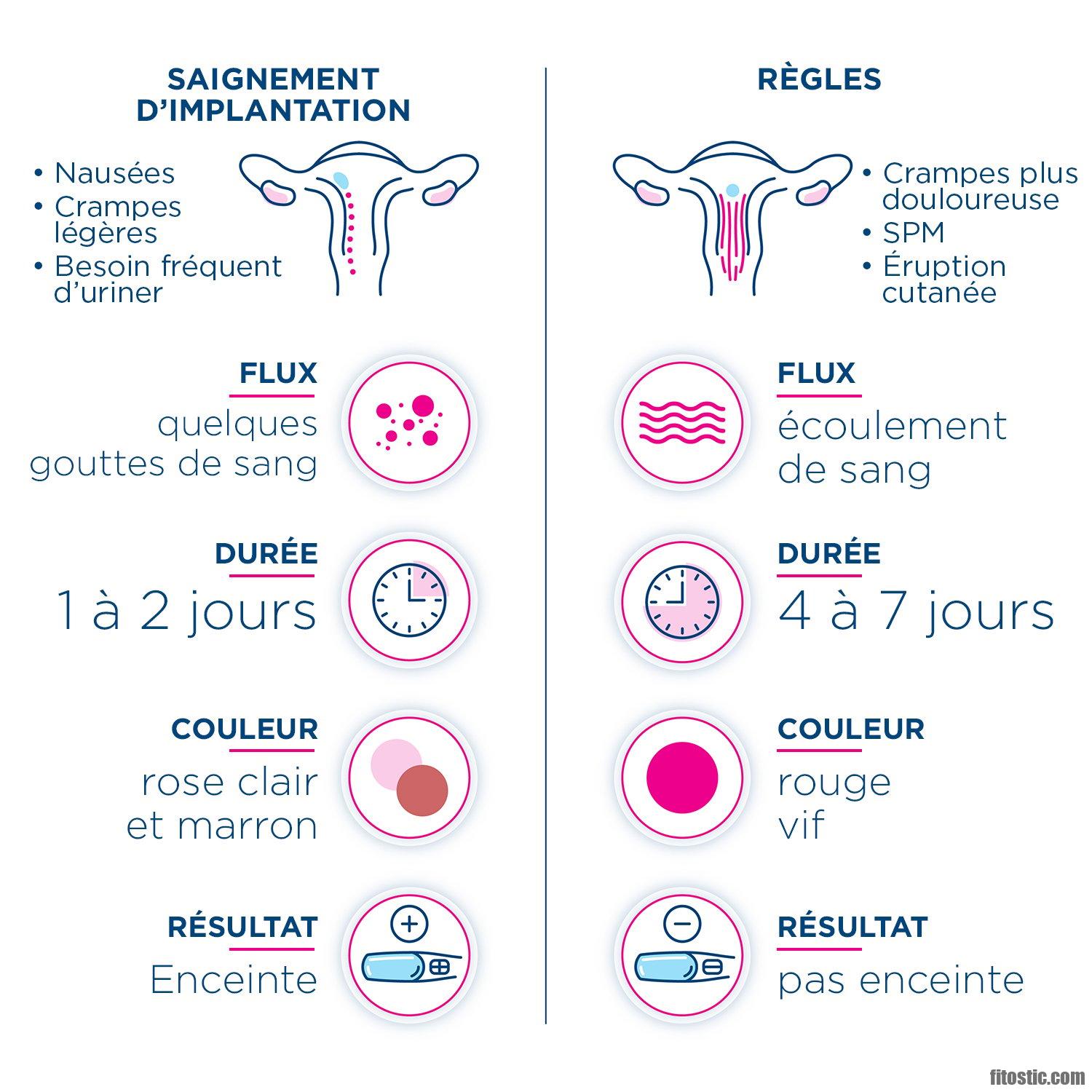 Comment Savoir Si J ai Eu Une Nidation comment-savoir-si-j-ai-eu-une-nidation