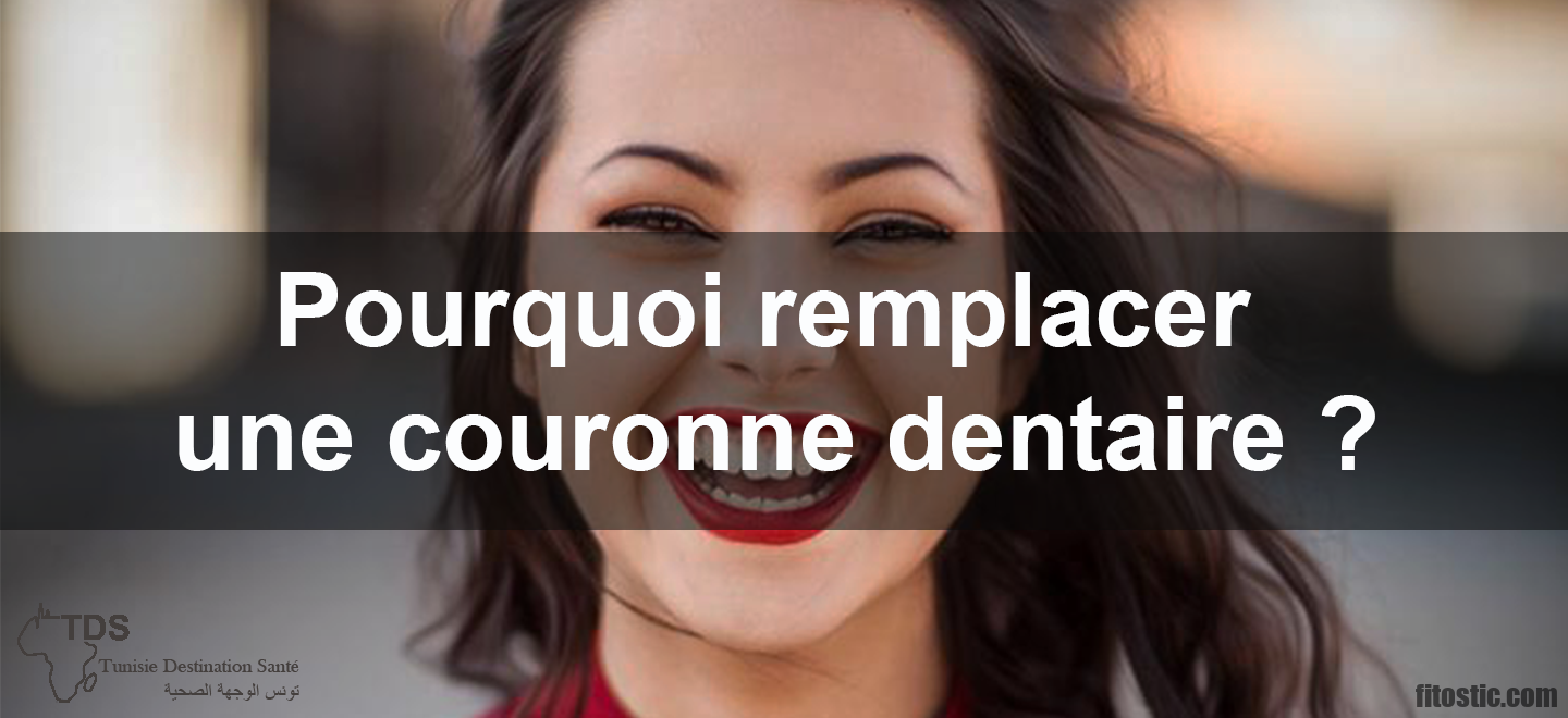 Quand doit-on changer une couronne ?