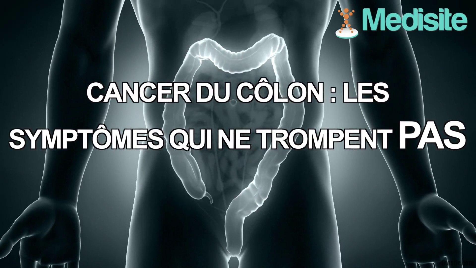 Quels sont les premiers signes du cancer du côlon ?