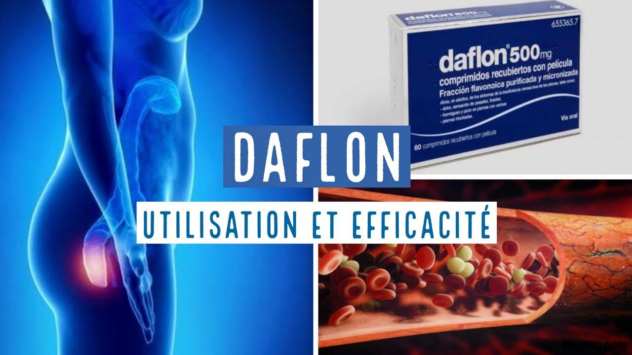 Qu'est-ce qui peut remplacer le daflon ?